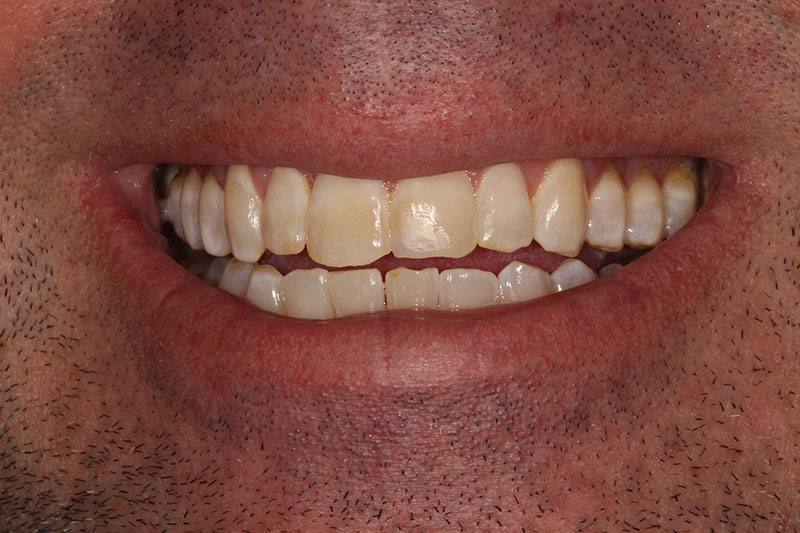 After image
