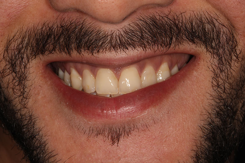 After image
