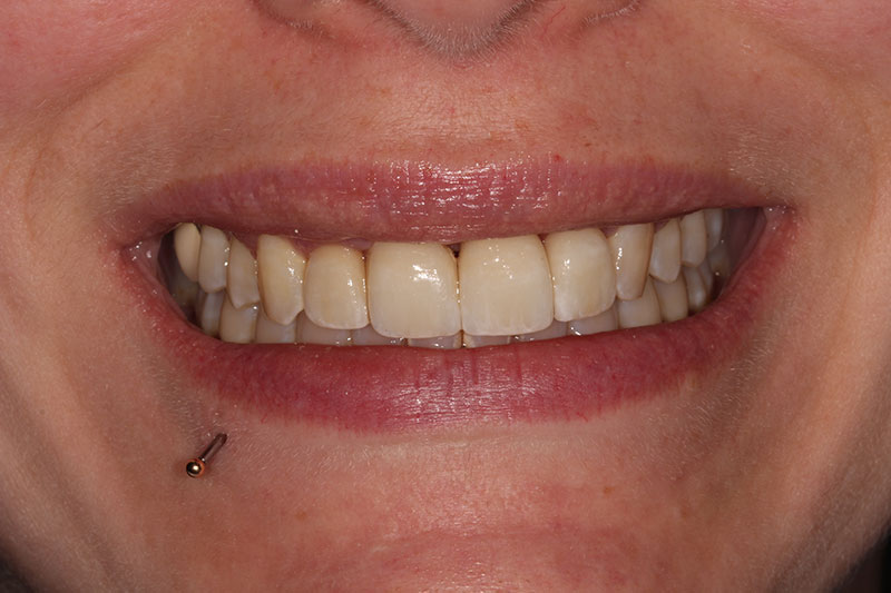 After image