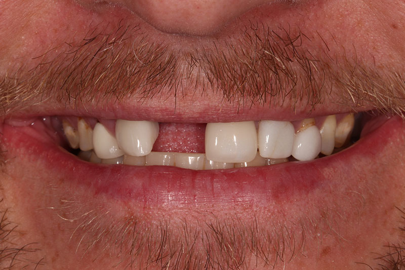 Before image