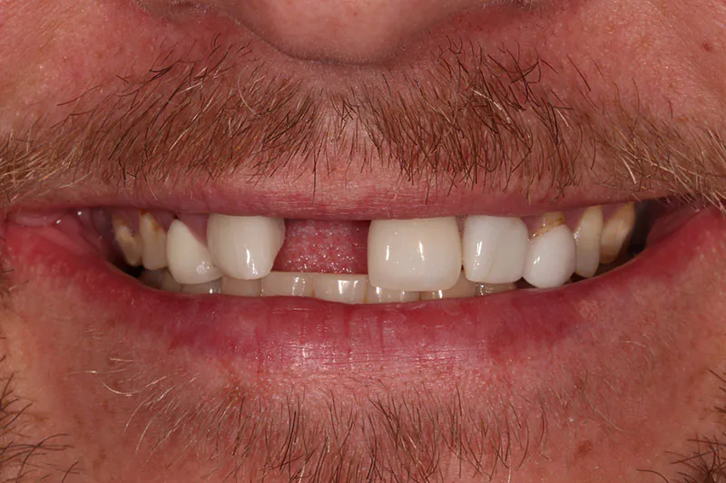 Before image