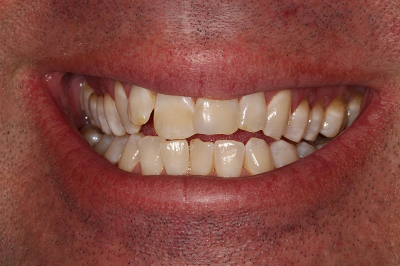 Before image
