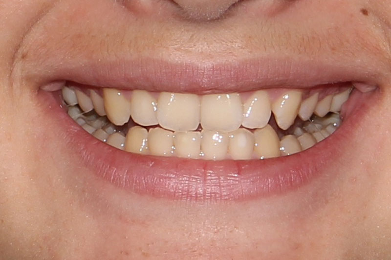 Before image