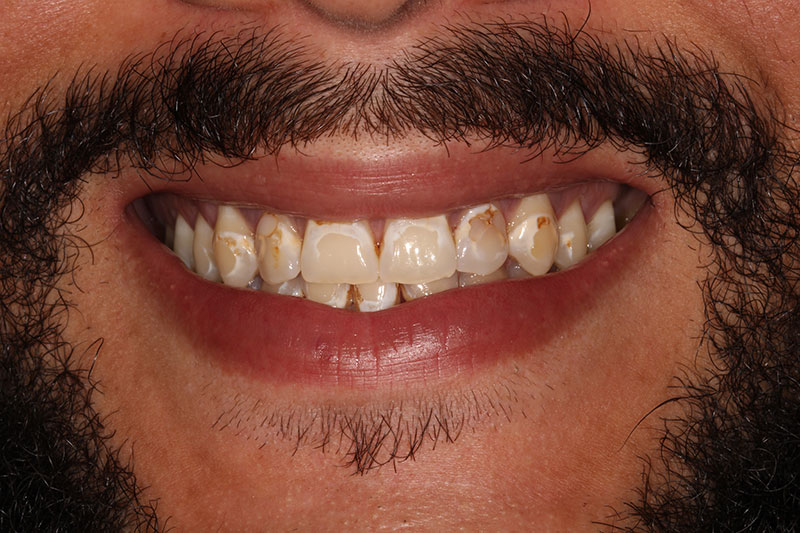 Before image