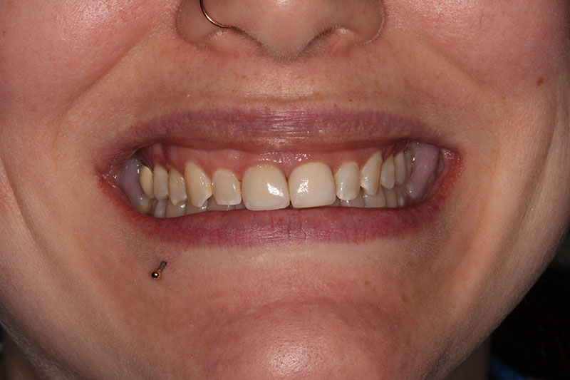 Before image